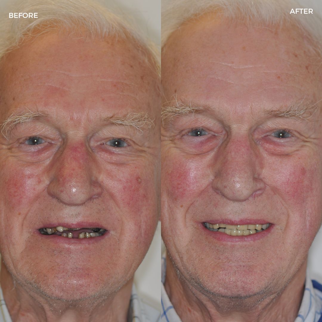 Village Dental - Helping Our Patients Smile Again