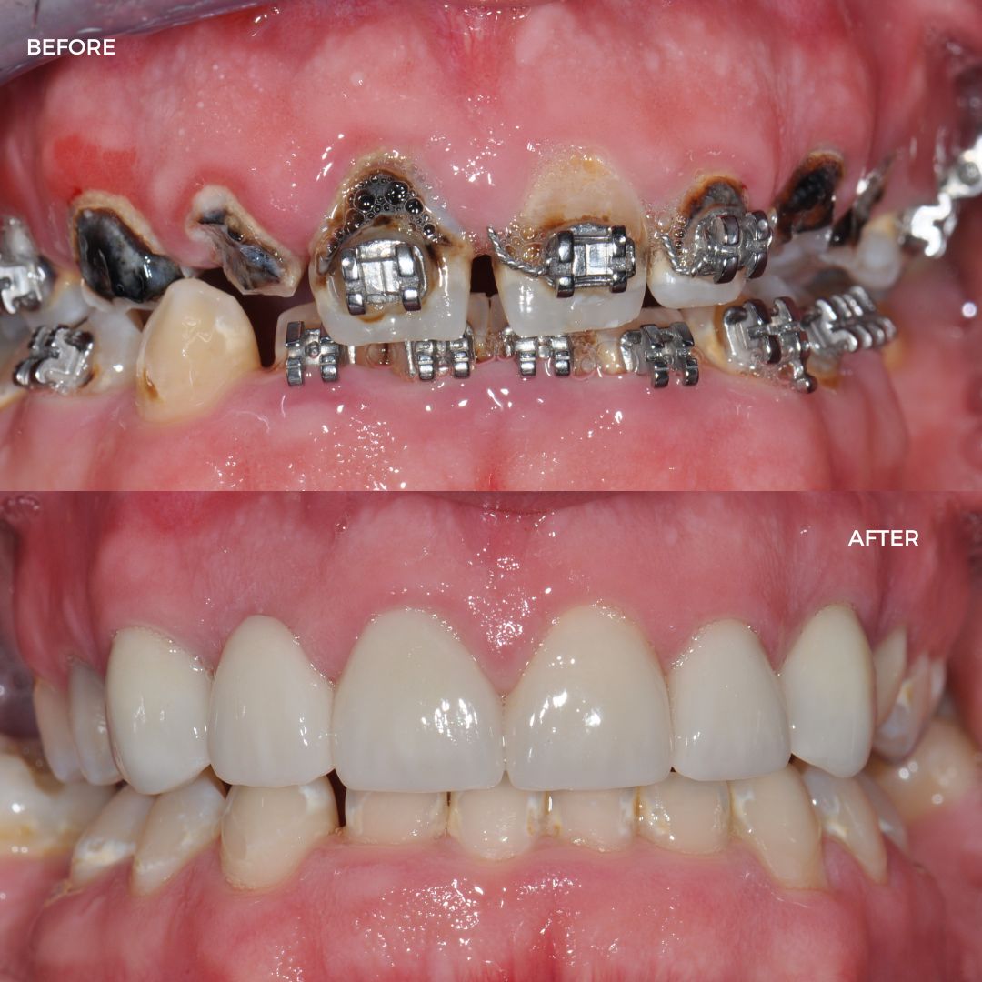 Before and after sedation treatment