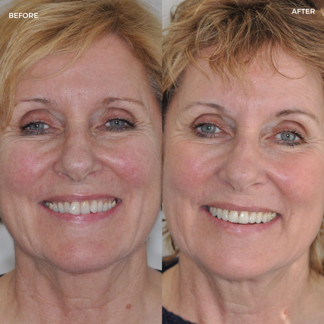 Village Dental - Helping Our Patients Smile Again