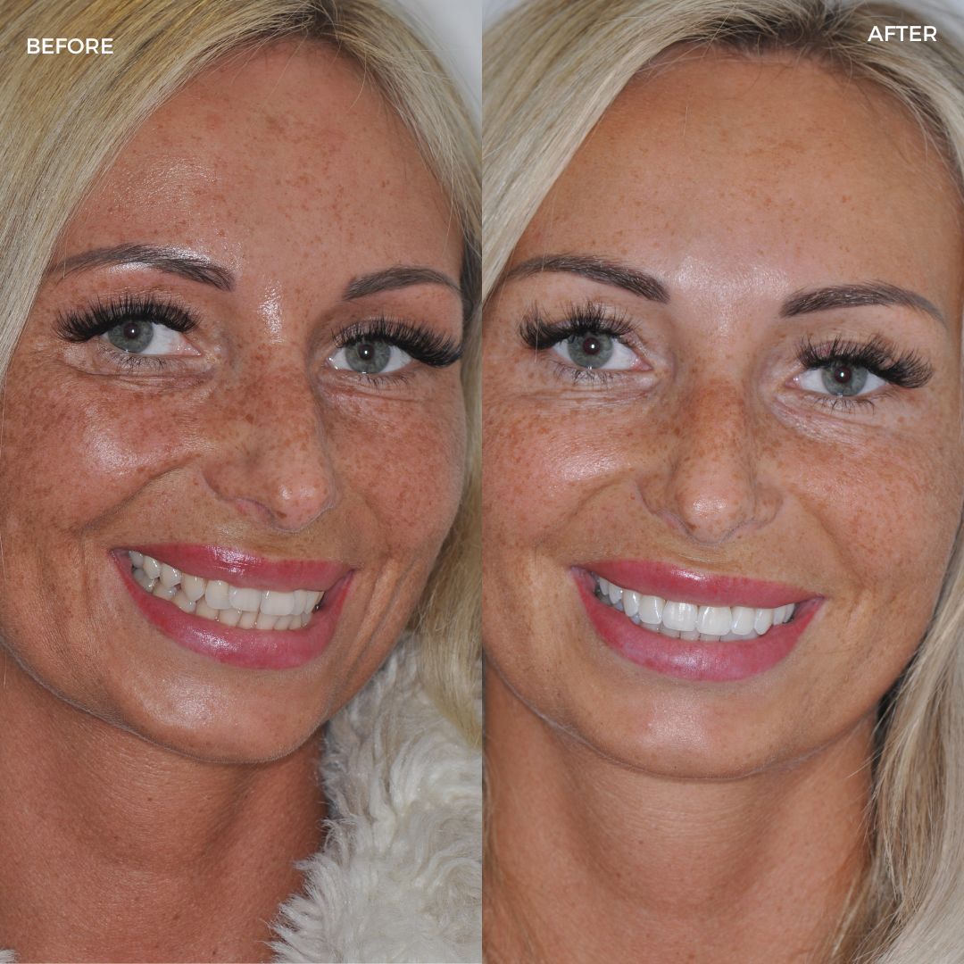 Village Dental - Helping Our Patients Smile Again